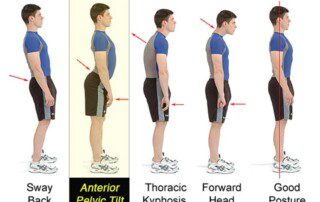 Pelvic Tilt 1